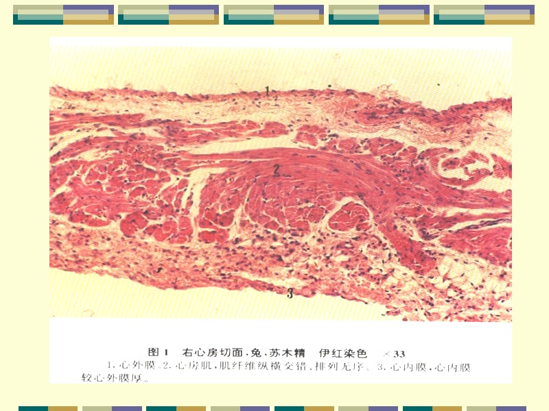 心壁的构造.ppt_第2页