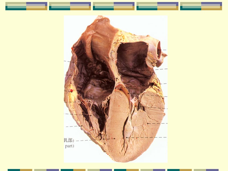心壁的构造.ppt_第3页