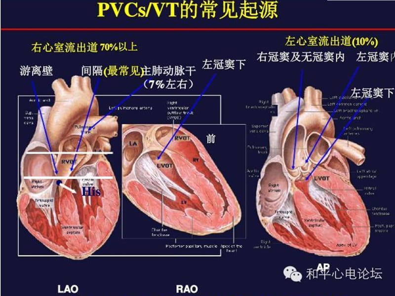 室早定位.ppt_第3页