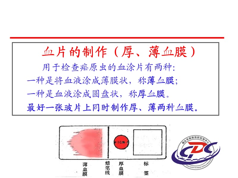 疟疾血片制作课件.ppt_第2页