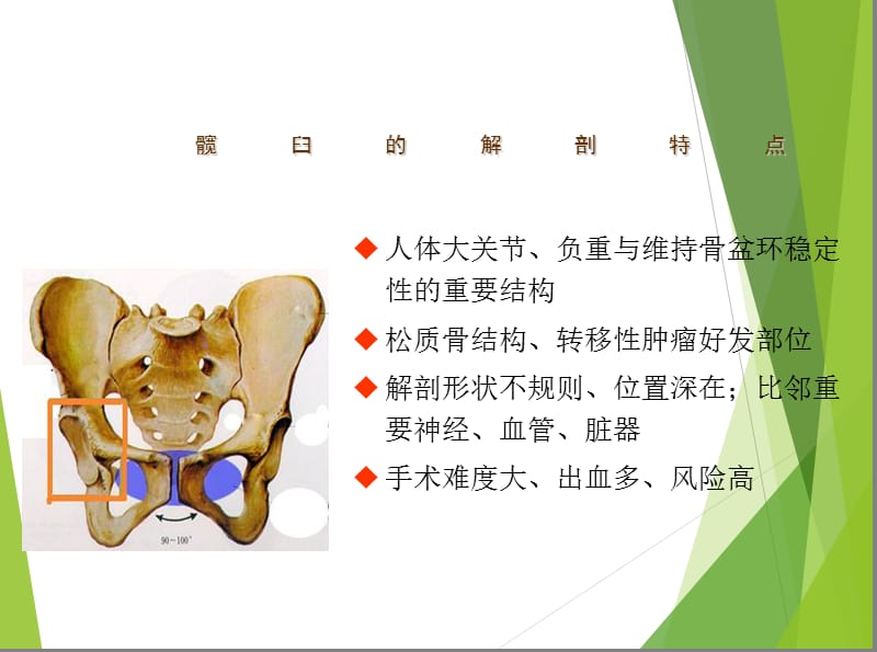 髋臼肿瘤的保肢治疗PPT课件.ppt_第2页