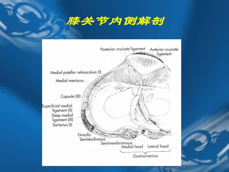 内侧副韧带损伤.ppt_第3页