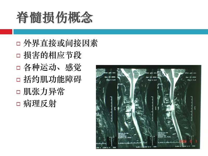 脊髓损伤概述.ppt_第3页