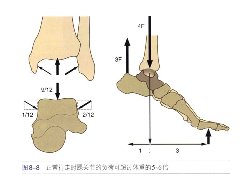 踝关节损伤诊断.ppt_第3页