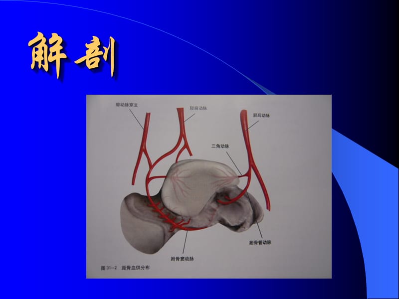 距骨骨折课件.ppt_第3页