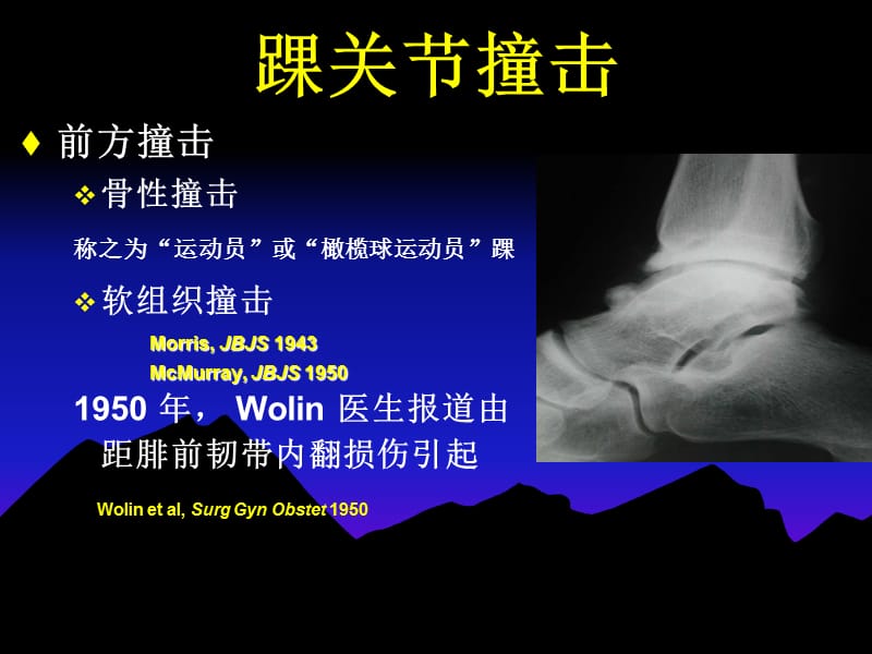 踝关节撞击 clanton.ppt_第2页