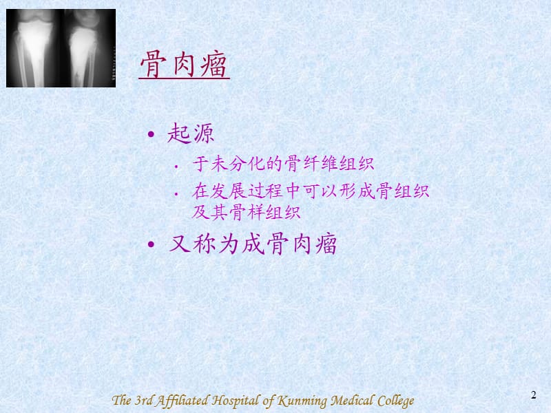 骨肉瘤(Osteosarcoma)-PPT课件.ppt_第2页