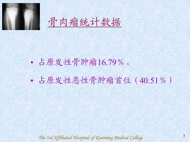 骨肉瘤(Osteosarcoma)-PPT课件.ppt_第3页