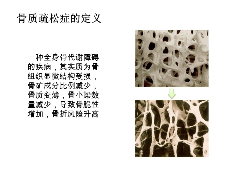 骨标志物.ppt_第2页