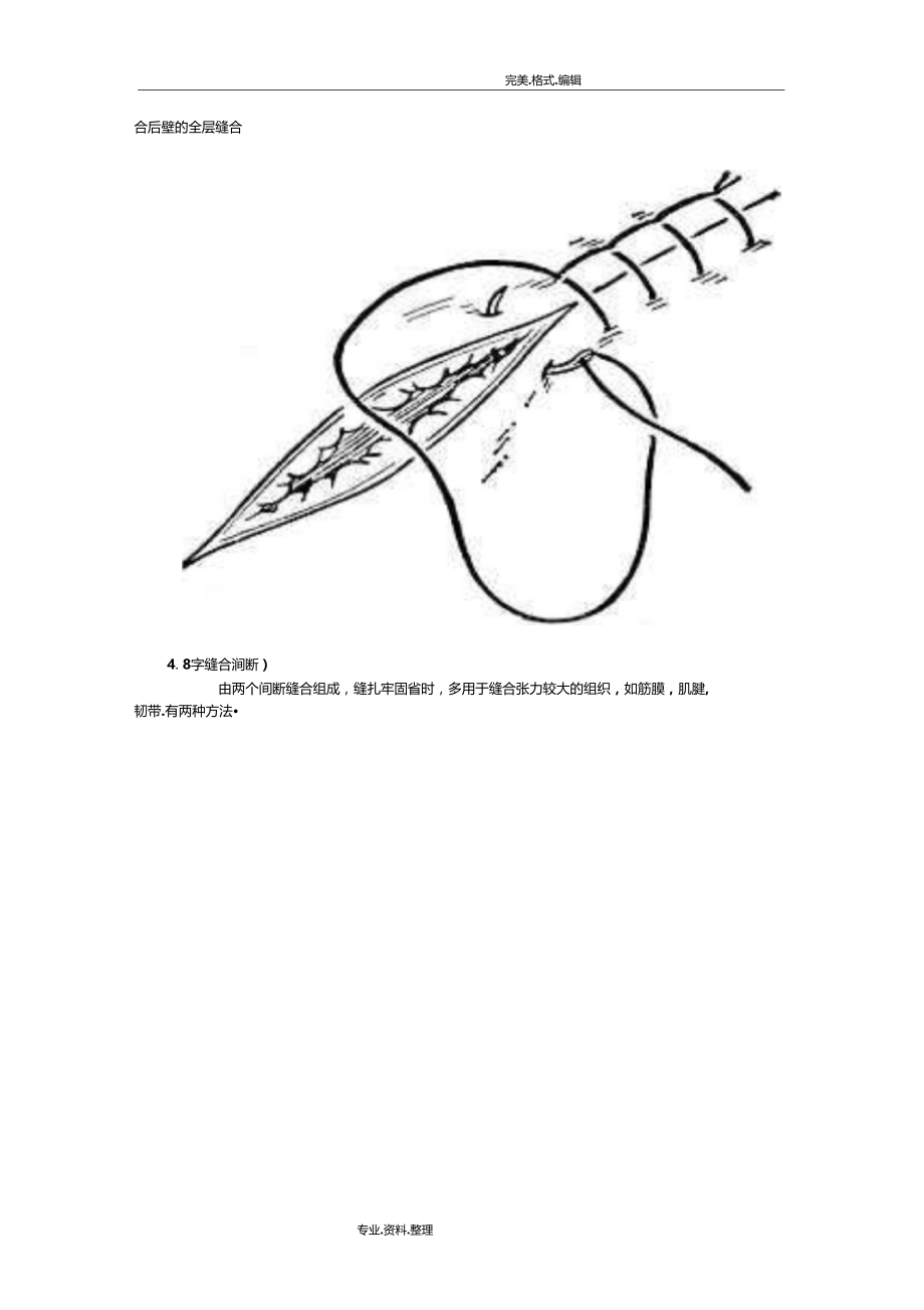 外科缝合的步骤及方法以和剪线的基本方法.doc_第3页