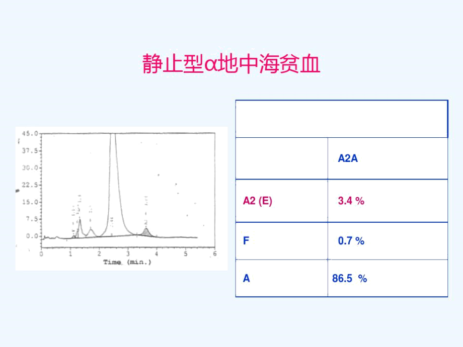 HPLC在血红蛋白病中的应用伯乐.docx_第2页