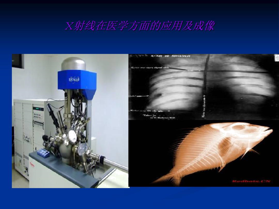 医学影像发展史.doc_第3页