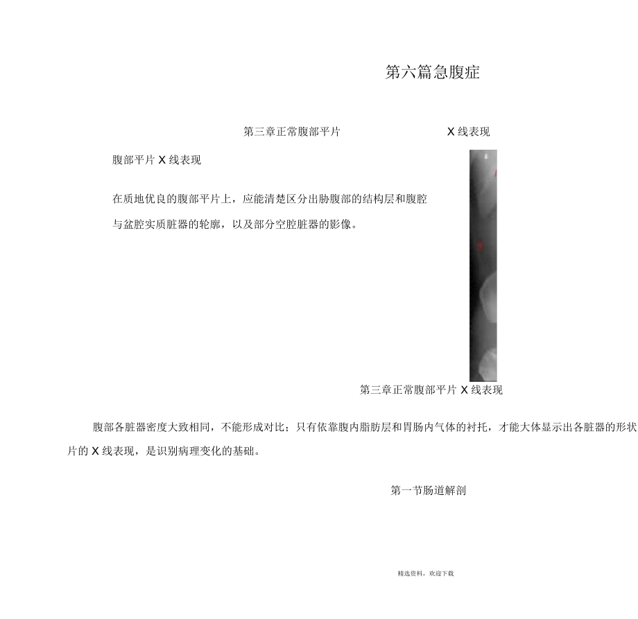 正常腹部平片X线表现.docx_第1页