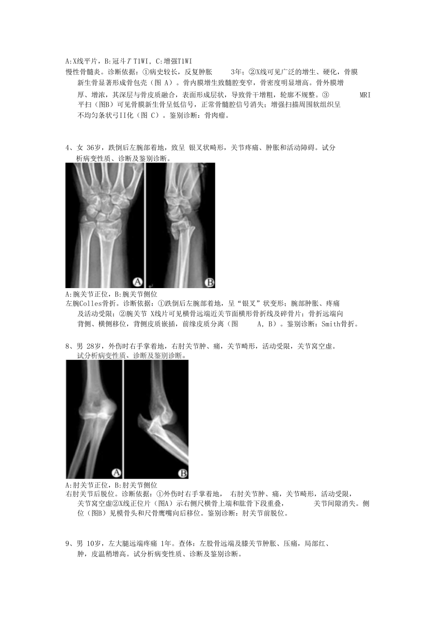 骨肌病例分析.docx_第2页