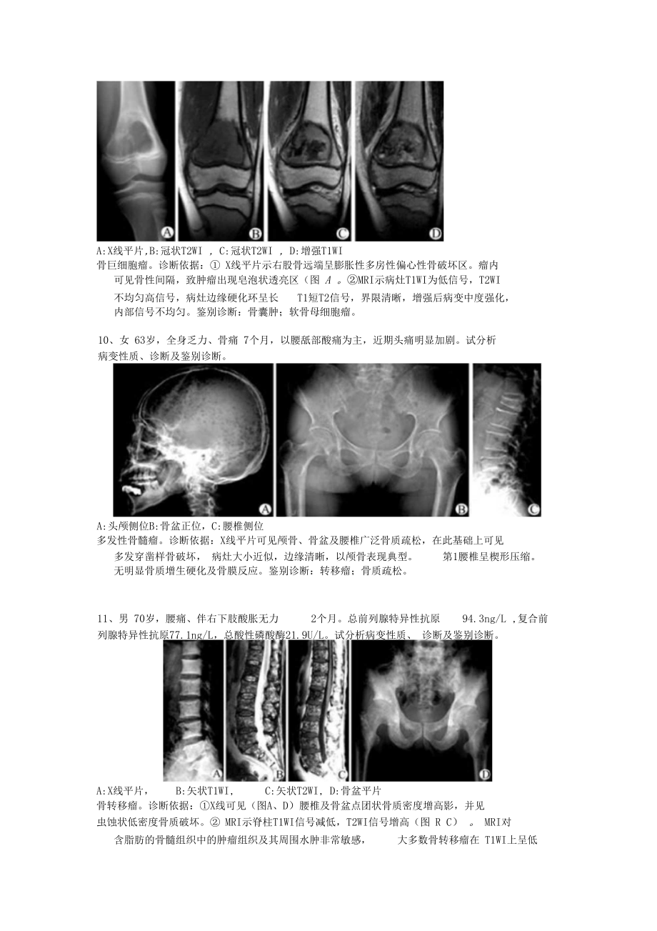 骨肌病例分析.docx_第3页