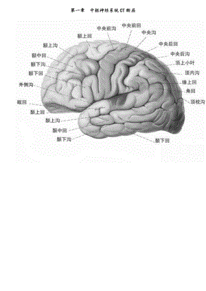 CT诊断图谱.docx