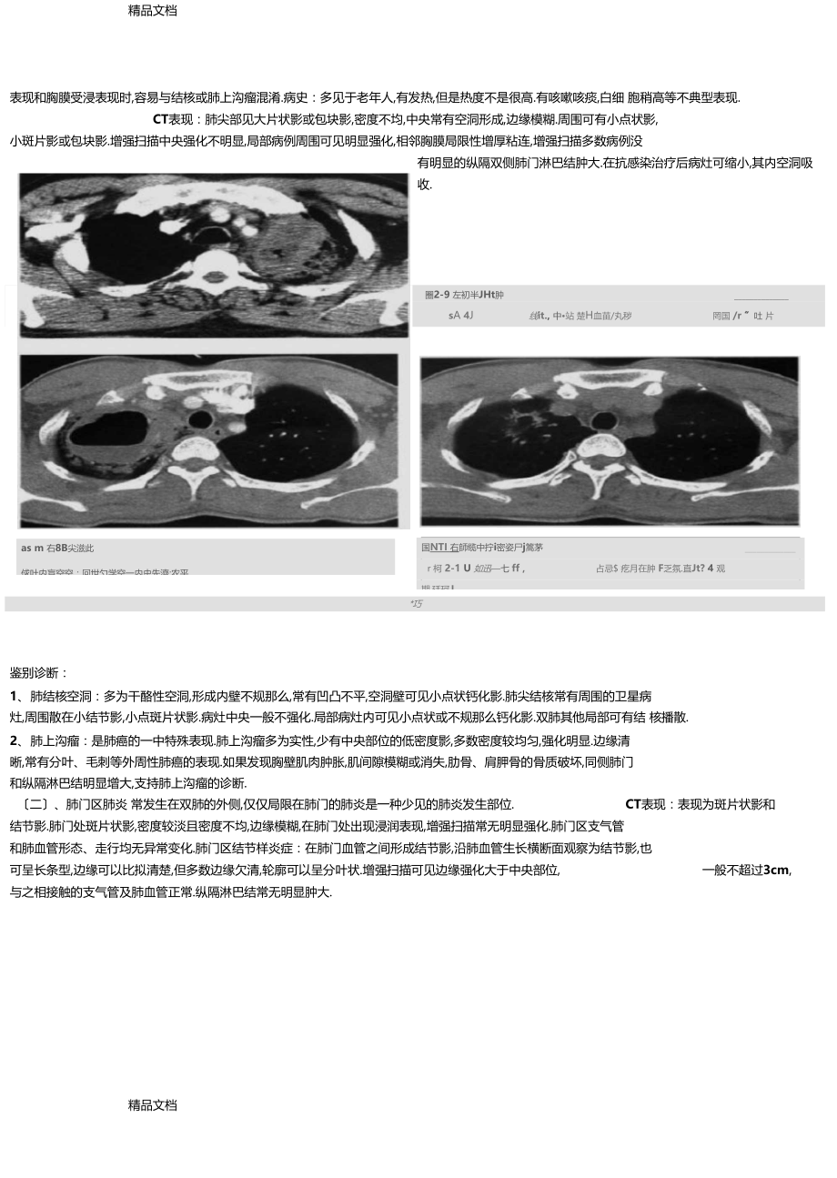 整理肺炎CT征象.docx_第3页