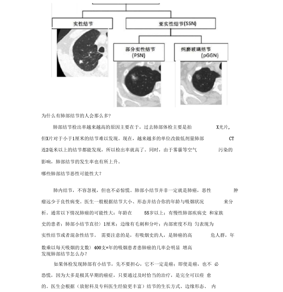 肺结节科普(20200517230218).docx_第3页