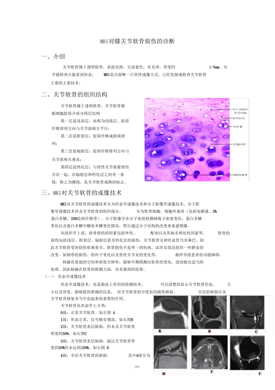 MRI对膝关节软骨损伤的诊断.docx_第1页