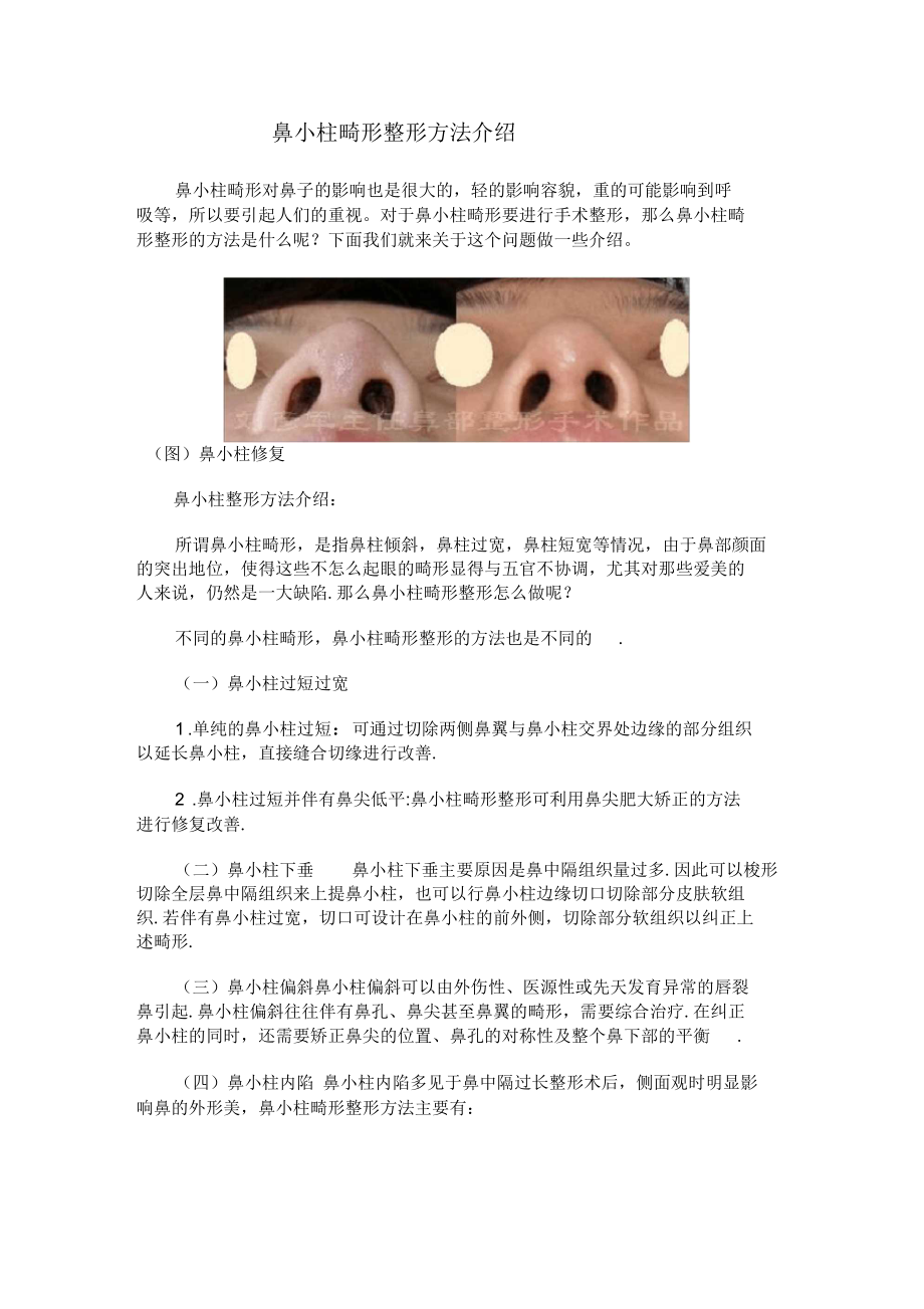 鼻小柱畸形整形方法介绍.docx_第1页