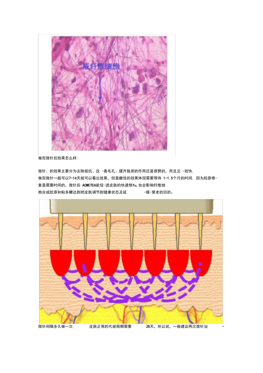 微针后前三天怎么护理？微针后反黑多久能好？我太难了~.docx_第3页