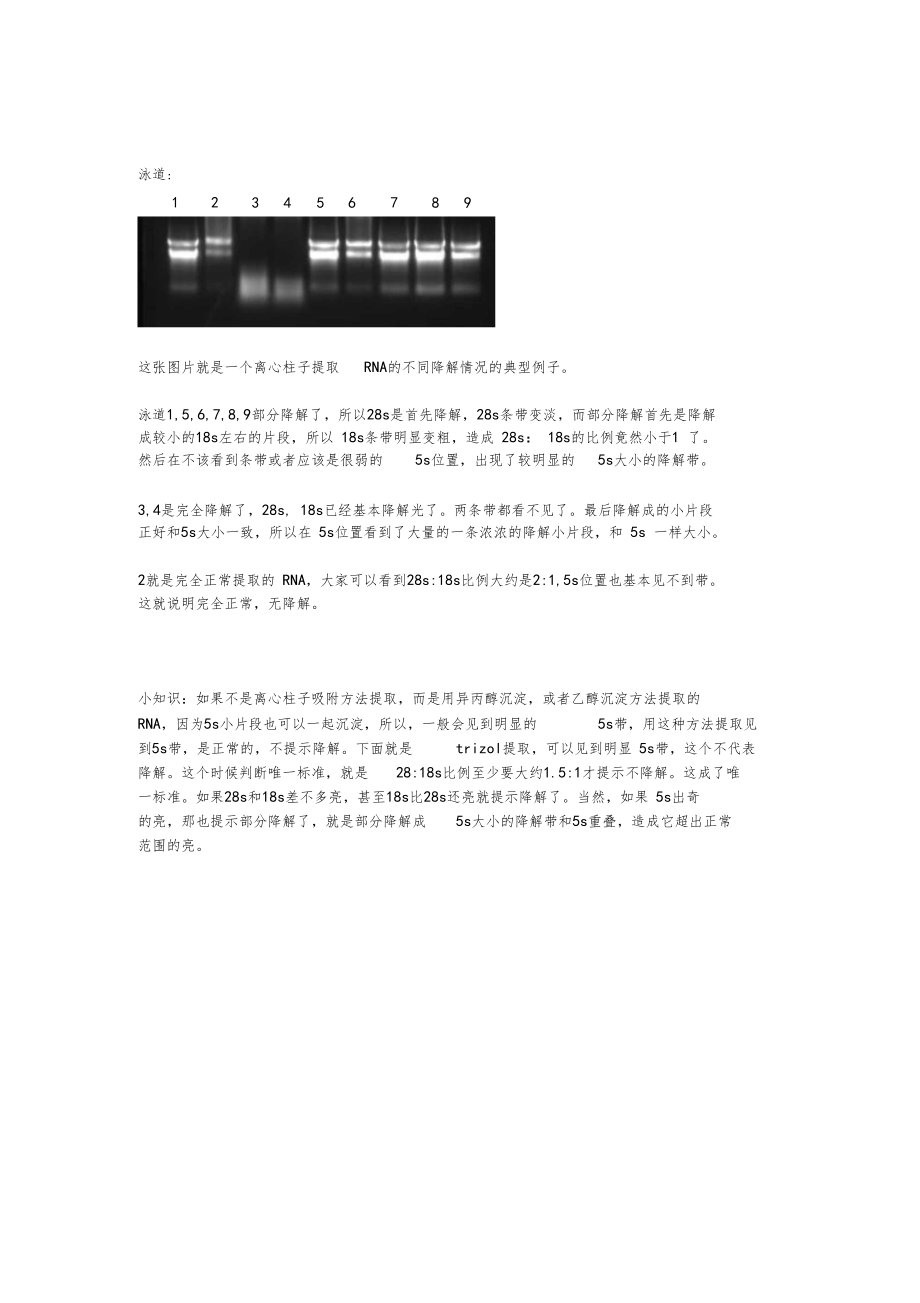 判断RNA是否降解知识.docx_第2页