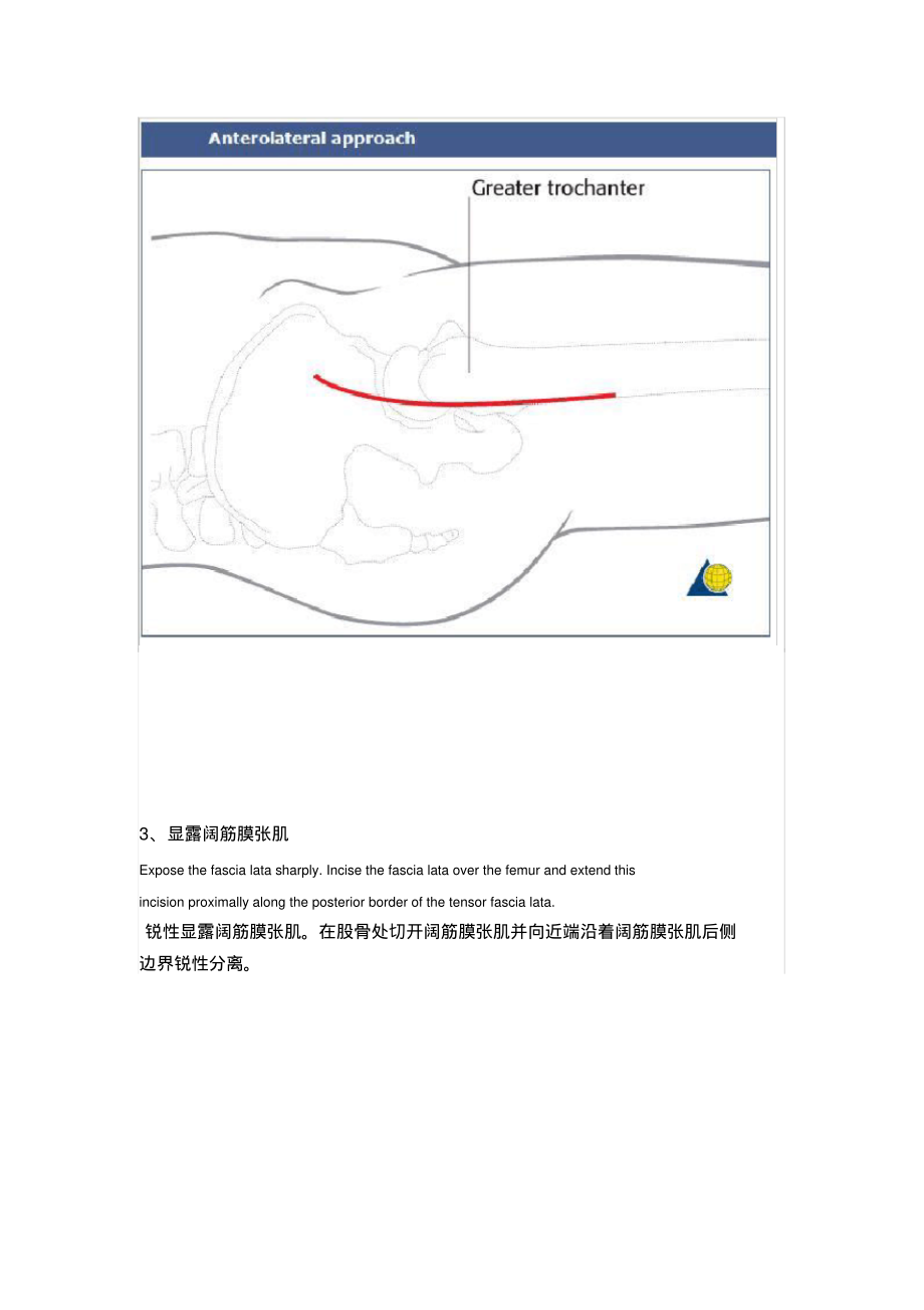 髋关节前外侧入路WatsonJones切口.pdf_第2页