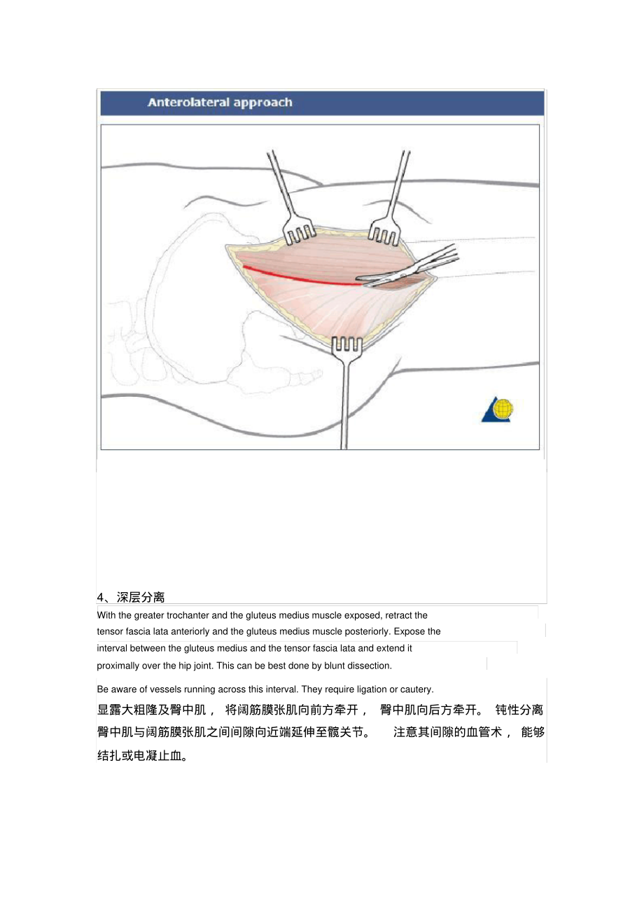 髋关节前外侧入路WatsonJones切口.pdf_第3页