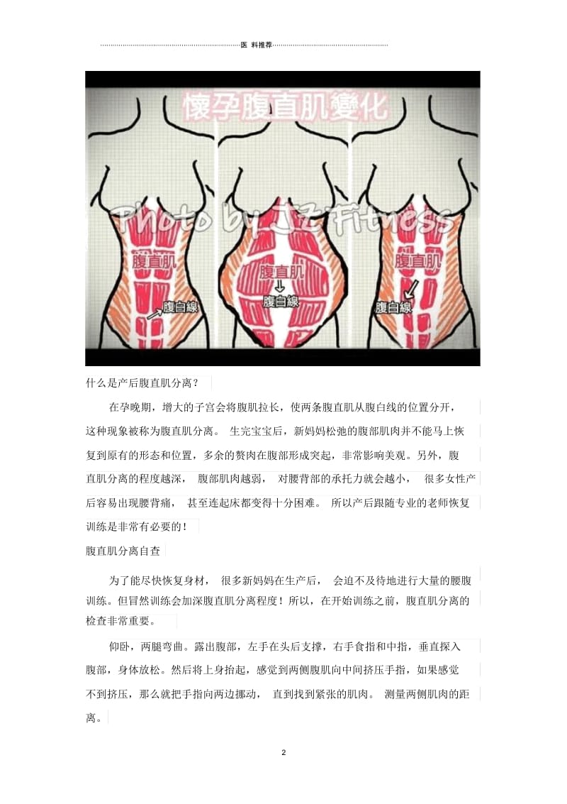 腹直肌分离的预防和治疗.docx_第2页