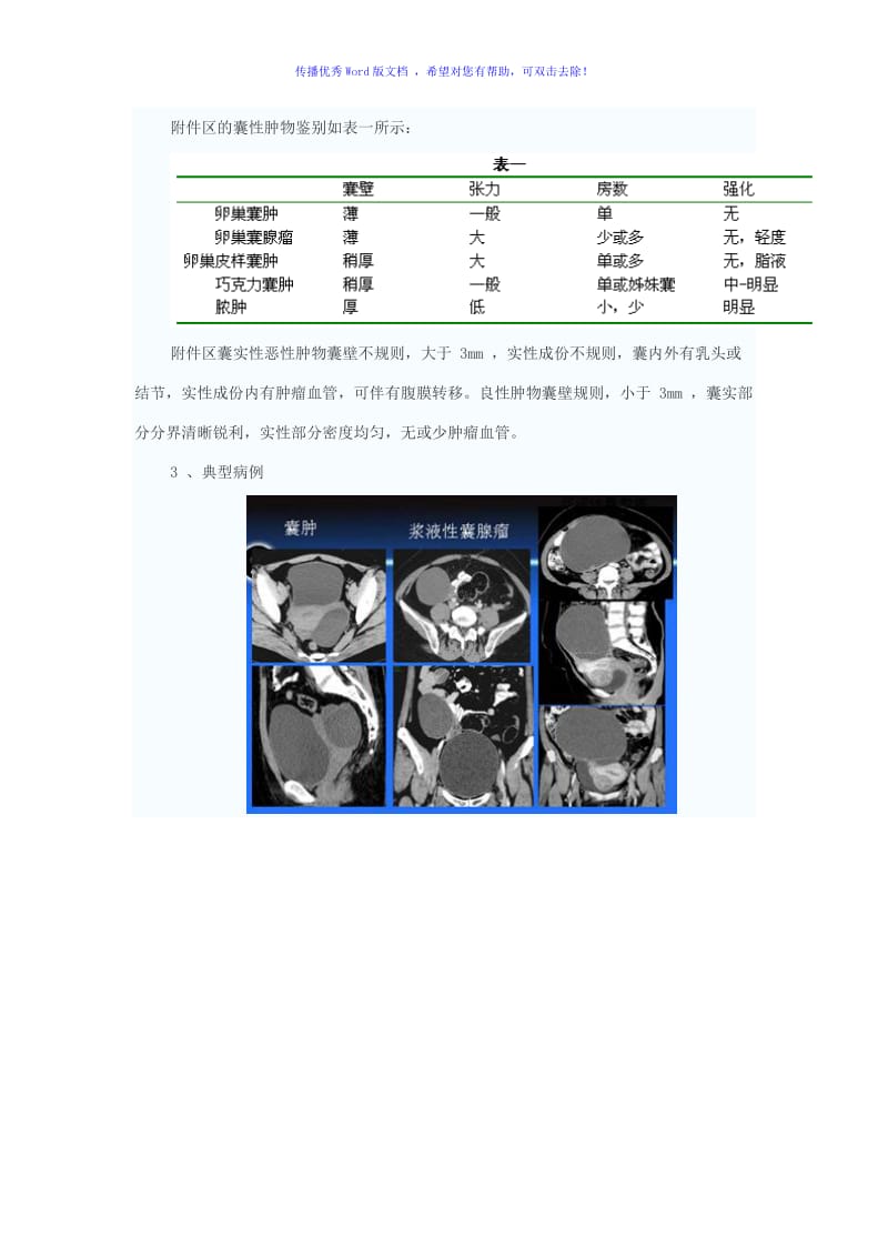 卵巢肿瘤的鉴别诊断Word编辑.doc_第3页