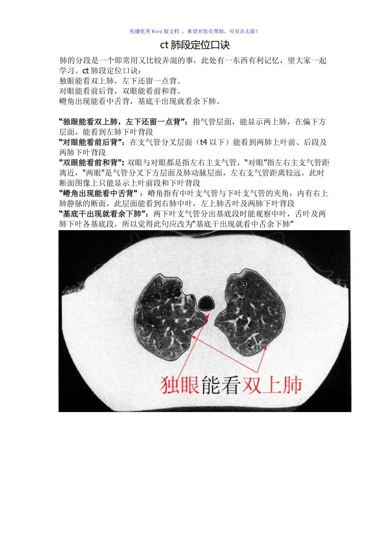 CT肺的分叶分段Word编辑.doc_第1页