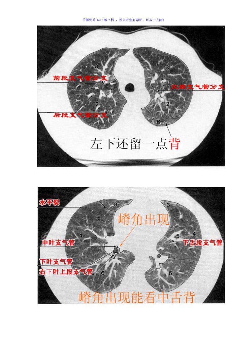 CT肺的分叶分段Word编辑.doc_第2页