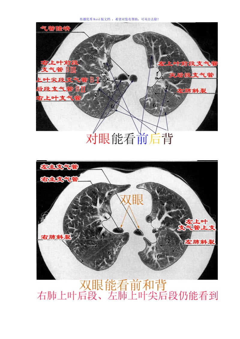 CT肺的分叶分段Word编辑.doc_第3页