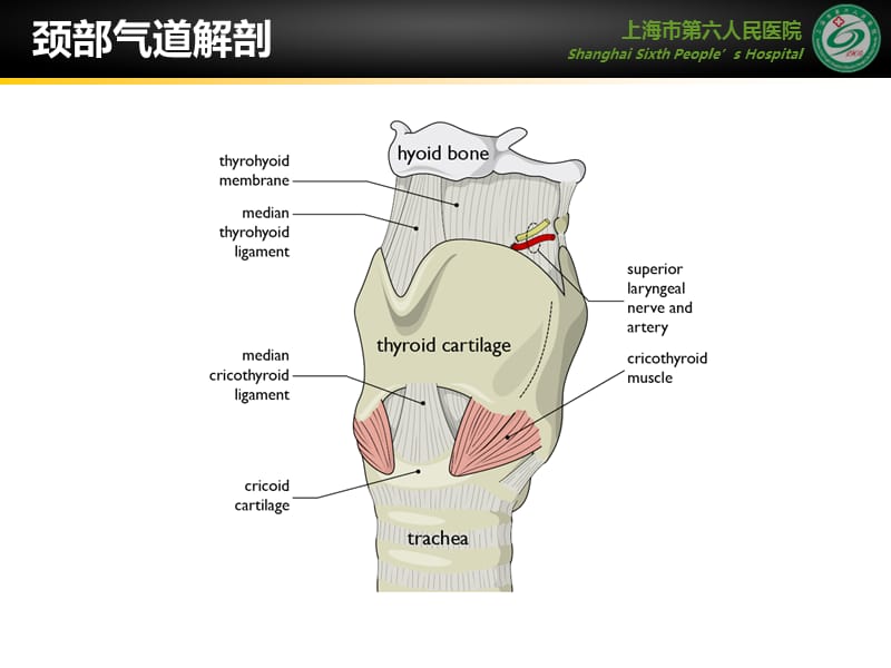 超声在气道管理中的应用课件.ppt_第2页