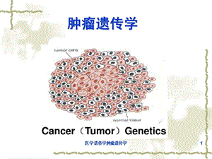 医学遗传学肿瘤遗传学课件.ppt