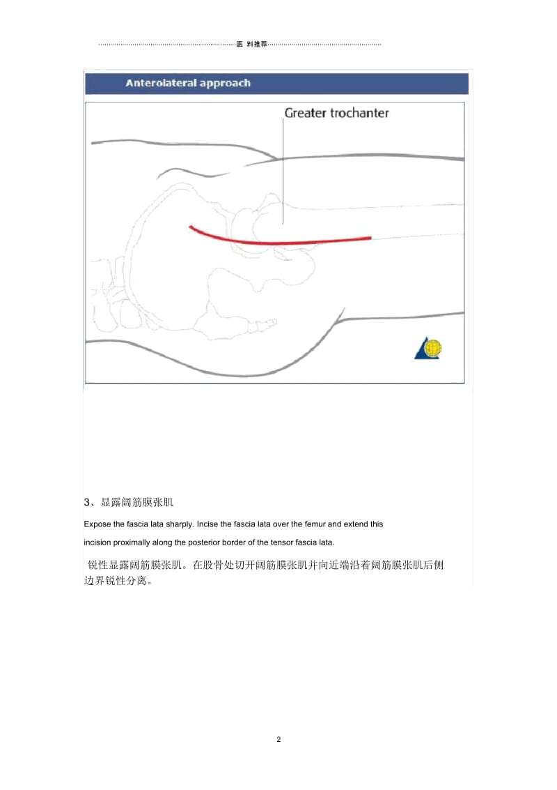 髋关节前外侧入路----Watson-Jones切口.docx_第2页