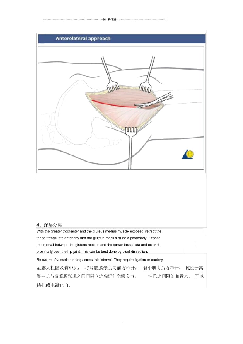 髋关节前外侧入路----Watson-Jones切口.docx_第3页