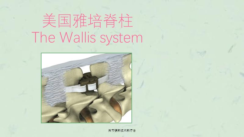 关节镜新技术新疗法课件.ppt_第1页