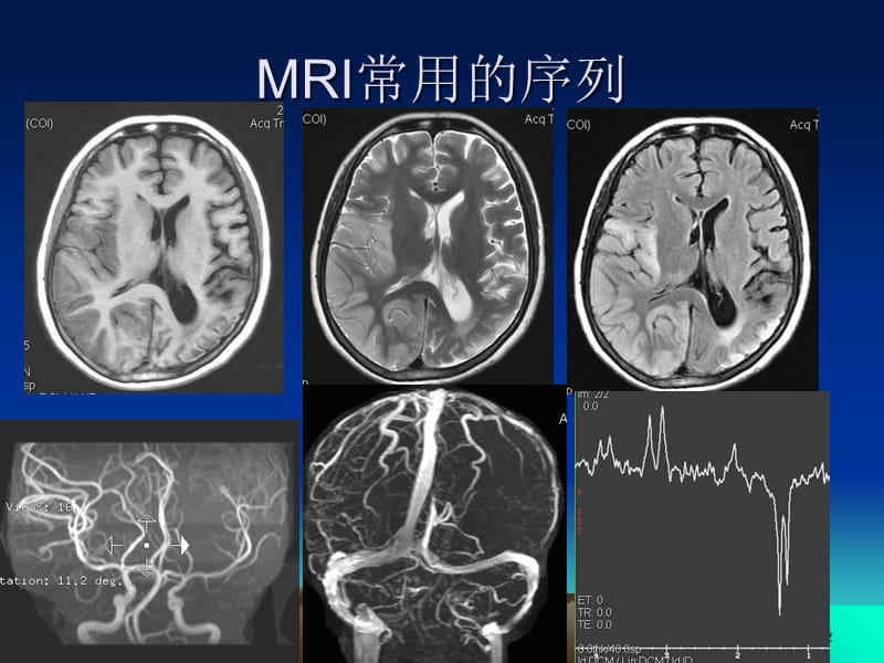 头颅MRI断层解剖PPT精选文档.ppt_第2页