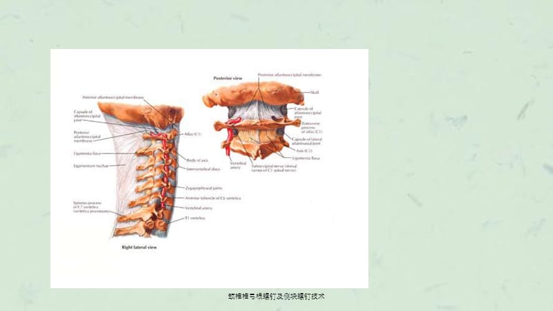 颈椎椎弓根螺钉及侧块螺钉技术课件.ppt_第2页