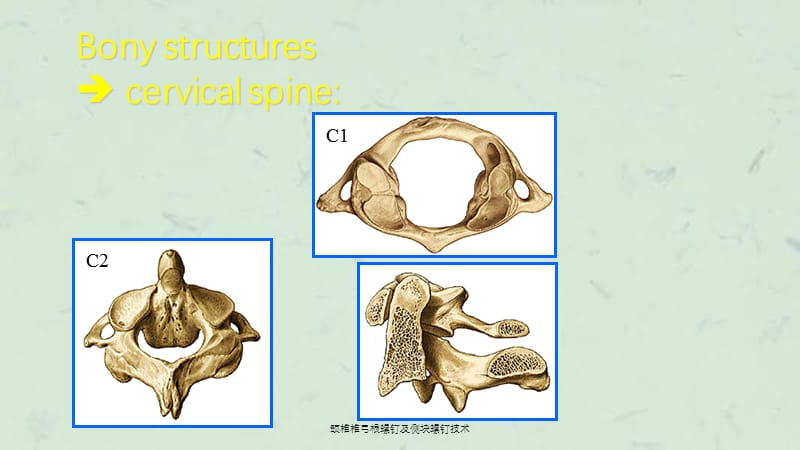 颈椎椎弓根螺钉及侧块螺钉技术课件.ppt_第3页