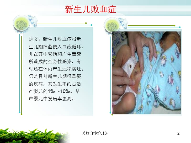 《败血症护理》课件.ppt_第2页