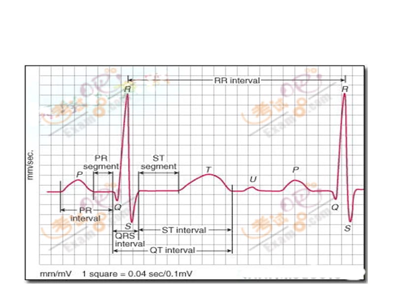 常见病心电图表现PPT课件.ppt_第2页
