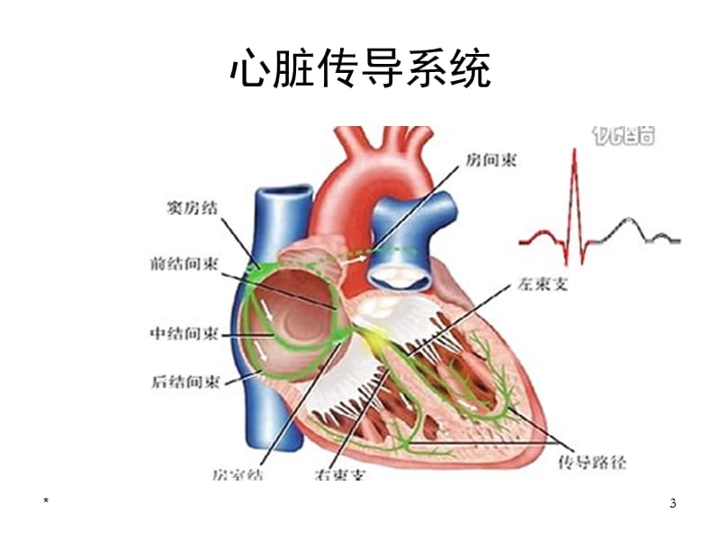 常见病心电图表现PPT课件.ppt_第3页