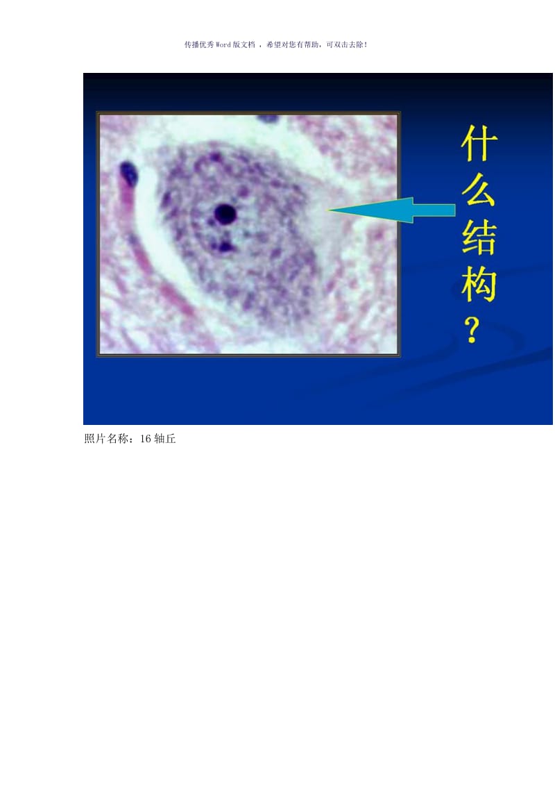 组织胚胎学标本考试(医学生必备)Word版.doc_第3页