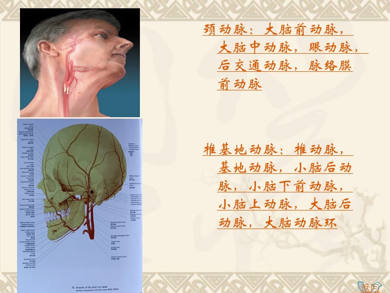 脑卒中PPT课件.ppt_第3页