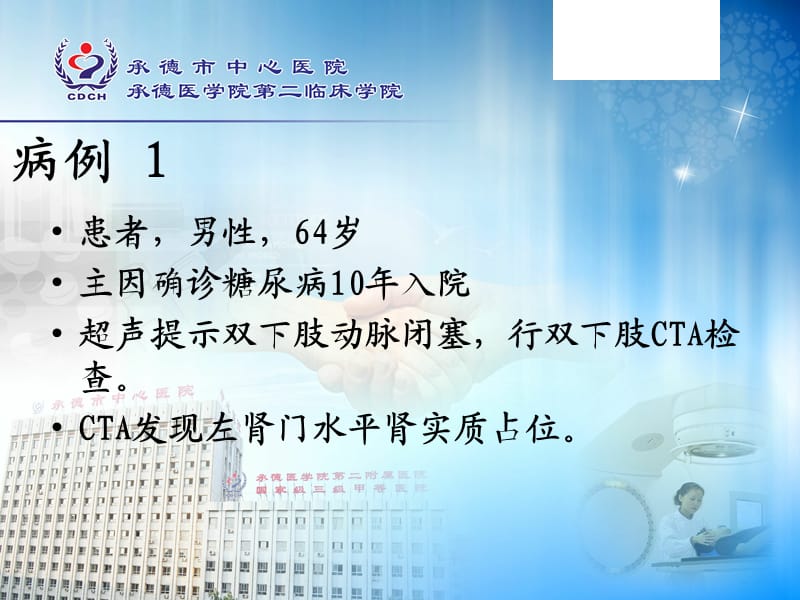 肾癌的CT表现.ppt_第2页