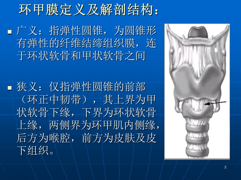 （推荐精选）环甲膜穿刺术.ppt_第2页