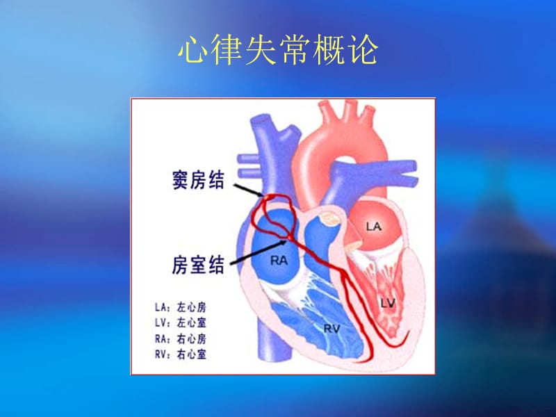 《心律失常的防治》PPT课件.ppt_第3页