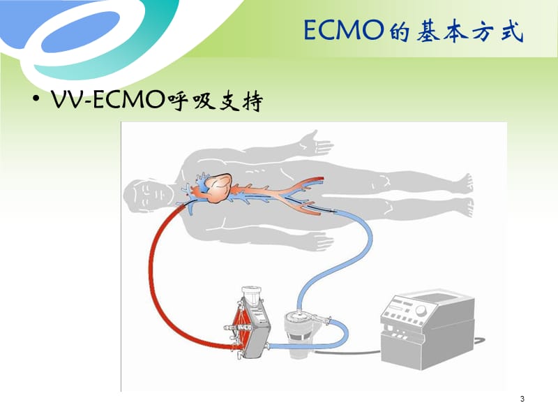 VA-ECMO治疗策略.ppt_第3页